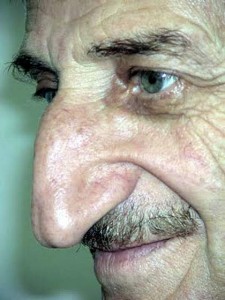 Mehmet-Ozyurek-Biggest-nose-04